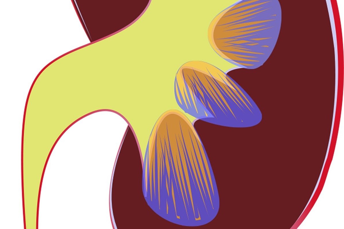 Üriner Sistem Ultrasonografisi